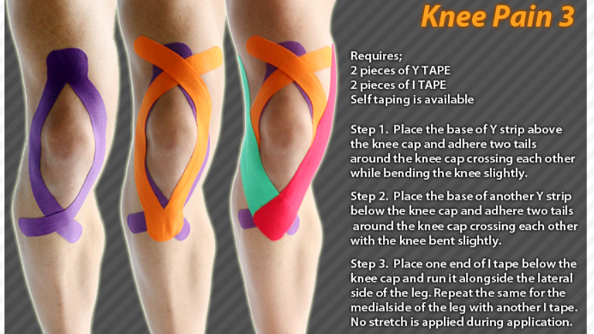 découvrez les techniques de taping du genou pour soulager la douleur, améliorer la stabilité et favoriser la récupération après une blessure.
