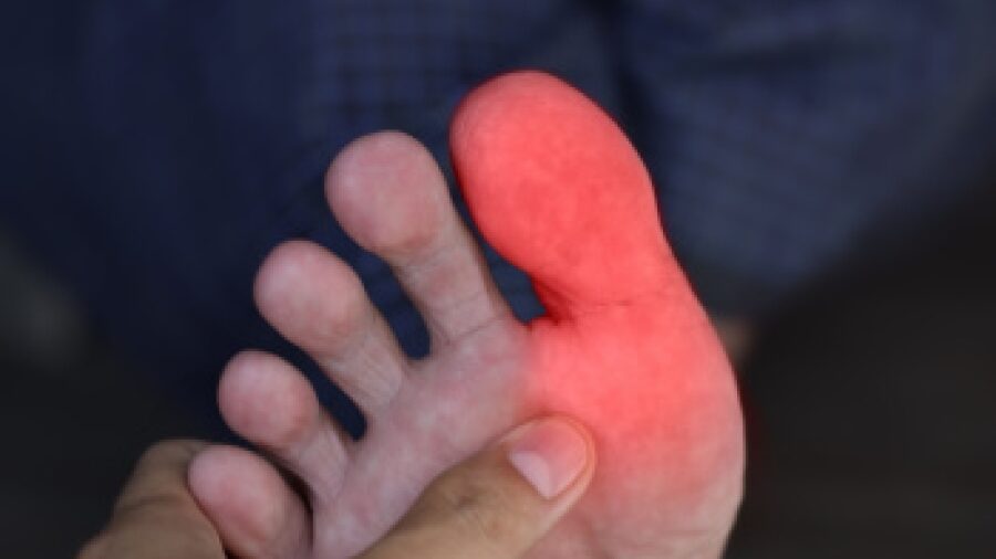 découvrez les causes des picotements aux pieds pendant la course et comment y remédier pour une expérience de running plus confortable et agréable.